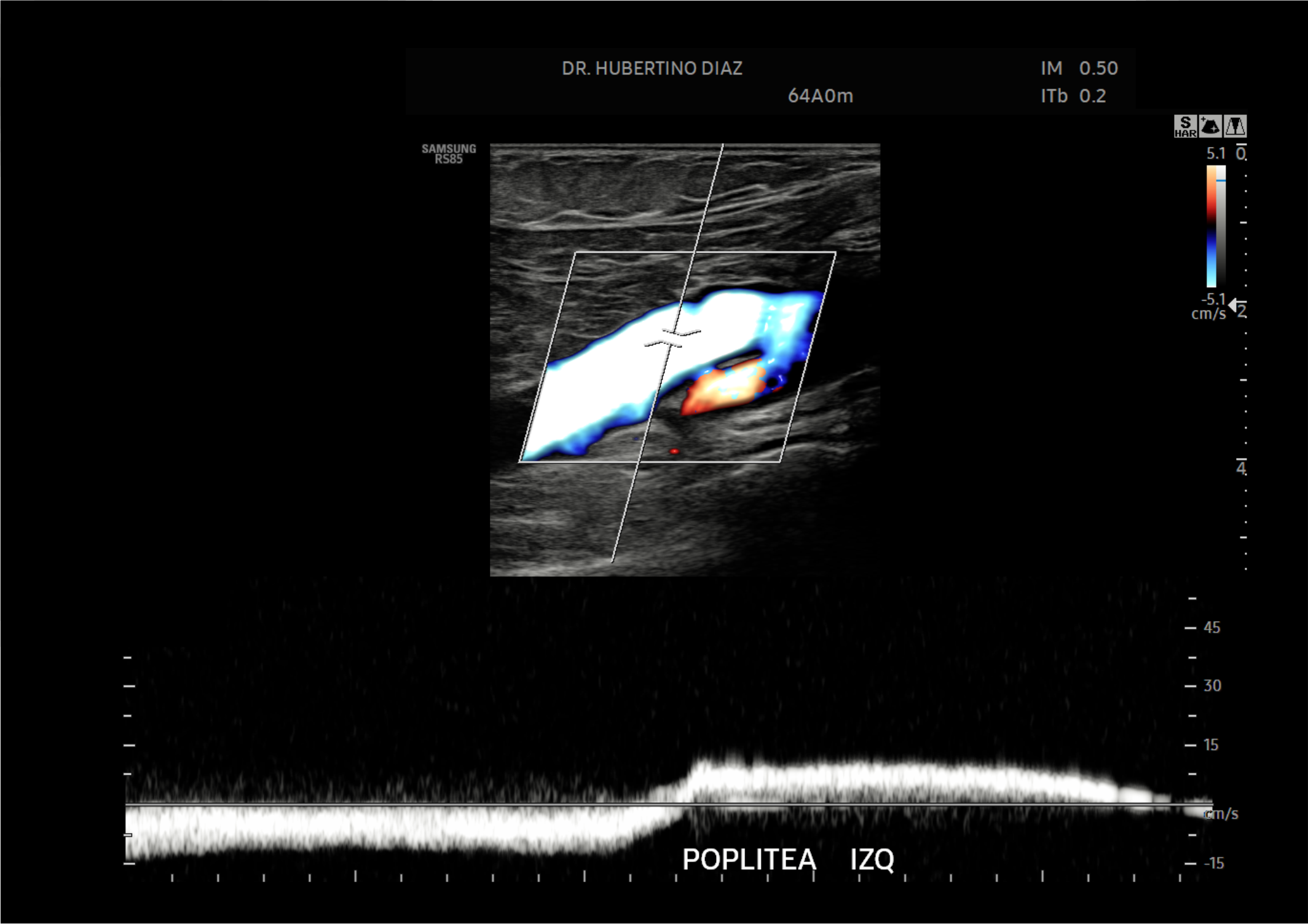 ecografía Doppler